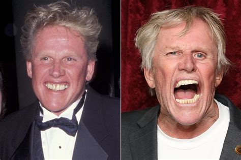 gary busey|gary busey before and after.